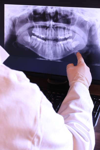 Best Knocked-Out Tooth Emergency  in Water Mill, NY